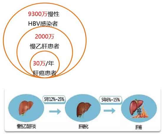 郑州哪家治疗乙肝的医院比较好?