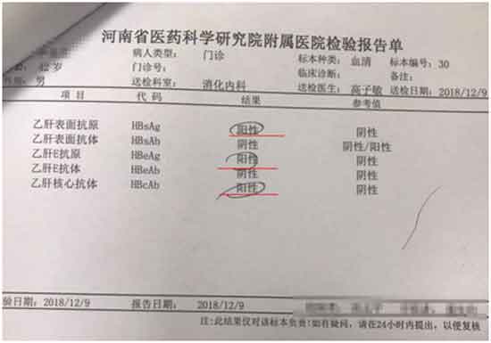 郑州肝病哪家做的好