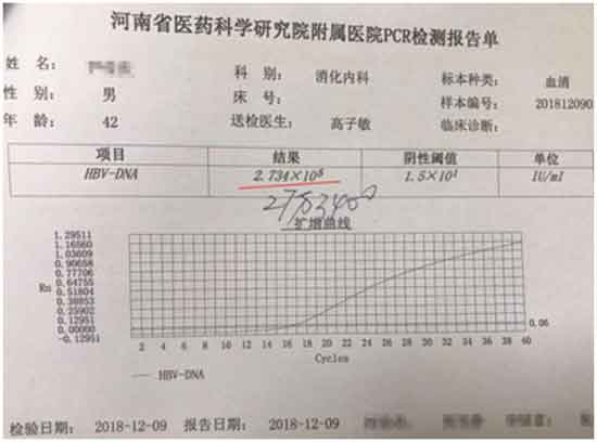 郑州肝病哪家做的好