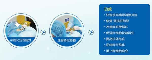 郑州哪家医院治疗肝硬化比较好