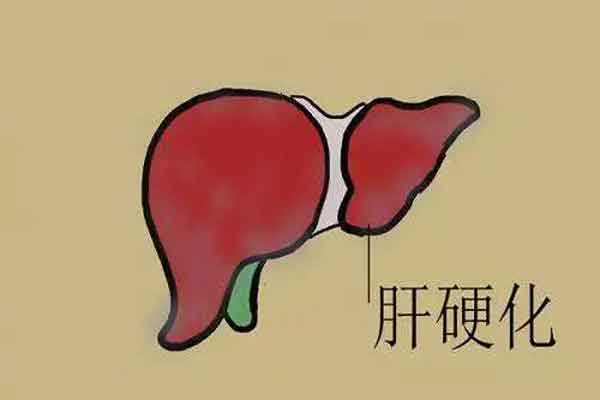 郑州哪家医院治疗肝硬化比较好