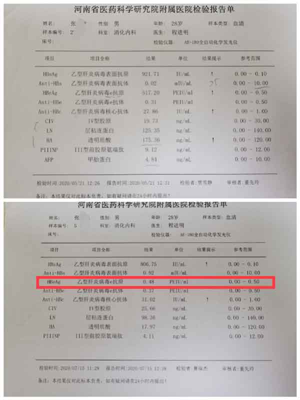 郑州什么医院治疗乙肝大三阳病好