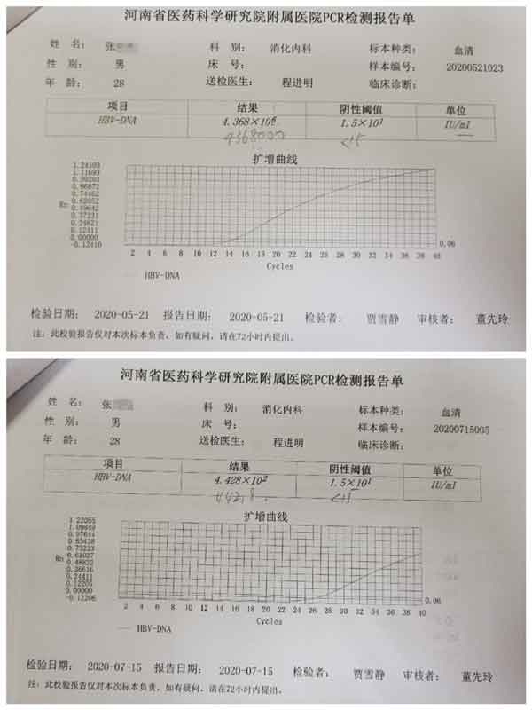 郑州什么医院治疗乙肝大三阳病好